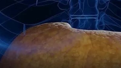 وداعًا لدهون الكبد؟.. 4 وجبات خفيفة قد تساعد في تحسين صحة الكبد