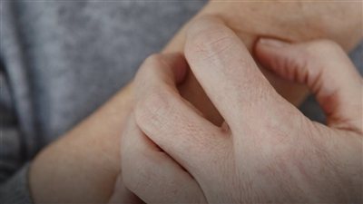 حكة الجلد قد تكشف أمراضًا.. إليك أبرز العلامات التحذيرية