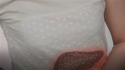 لا تقتصر أعراض أمراض الكبد المتقدمة على التعب واصفرار الجلد.. هل يمكن أن تسبب أيضًا صعوبة في الكلام؟