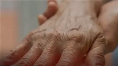 تنميل وخدر اليدين.. أسباب قد تكون بسيطة وأخرى تستدعي الانتباه