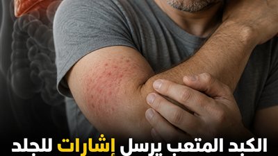 الكبد المتعب يرسل إشارات للجلد.. 5 علامات غير متوقعة انتبه إليها ! 