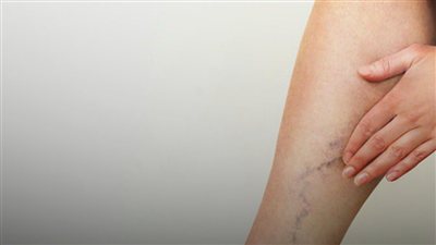فحص القدمين في المنزل.. 7 ملاحظات مهمة لمرضى السكري