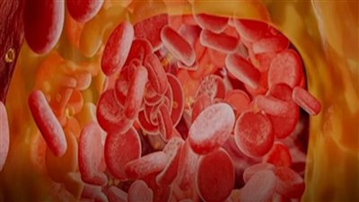 أحدث دواء لارتفاع الكوليسترول.. علاج جديد يخفضه بنسبة تصل إلى 52%