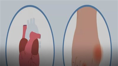 أعراض أمراض القلب في القدمين.. 3 علامات انتبه إليها
