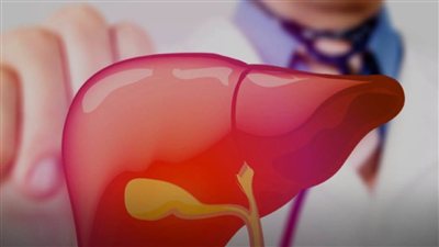 لمرضى الكبد الدهني  7 أطعمة يُنصح بتجنبها قدر الإمكان