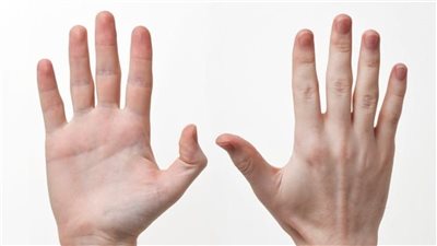 أكثر 7 أعراض لتلف الكلى نهائيًا تظهر في الساقين واليدين خليك حذر
