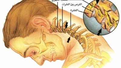 هل تشعر بآلام غريبة في الرقبة أو الظهر مؤخرًا؟ فربما السبب ليس عضليًا بل نفسيًا بحتًا ناتج عن سلوك خاطئ يتكرر دون وعي