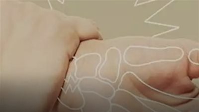 تُعتبر هشاشة العظام من الأمراض الصامتة التي لا تظهر أعراضها بشكل واضح في المراحل الأولى، إلا أنها قد تتسبب مع الوقت في مضاعفات خطيرة.. تعرف عليها