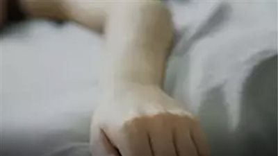 يعاني بعض الأشخاص من تنمُّل إحدى اليدين أو كليهما عند الاستيقاظ من النوم، مما يشعرهم بالقلق 