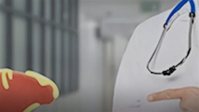 أعراض مرض الكبد الدهني لا تقتصر فقط على اليرقان وألم البطن والانتفاخ