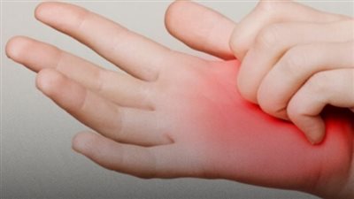 حكة مستمرة في اليدين أو القدمين قد تكون عرضًا لهذه الأمراض!