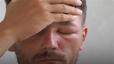انتفاخ حول العينين عند الاستيقاظ أسباب وطرق العلاج 