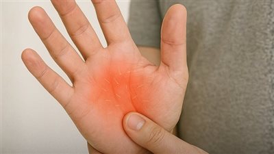 أطباء يحذرون وخز اليد الخفيف عرض لهذه الأمراض ! 