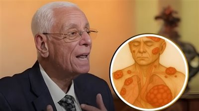 الدكتور حسام موافي: انتبه إذا استمرت هذه الأعراض لأسابيع… فقد تكشف إصابتك بأورام صامتة ! 