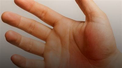 انتبه  تنميل اليدين أثناء النوم علامة على هذه الأمراض 