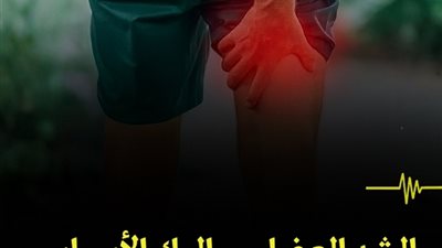 الشدّ العضلي.. إليك الأسباب وطرق العلاج ! 