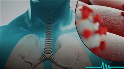 تراكم الماء على الرئة من الحالات الطبية الخطيرة