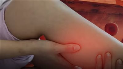 ما هي علامات ارتفاع الكوليسترول في القدمين؟