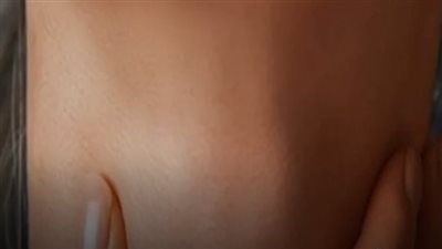 قد تظهر بعض العلامات التي تشير إلى الإصابة بورم في الحنجرة ! 