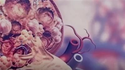 كيف أعرف أن لدي تلف في الكلى؟
