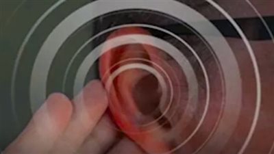 هناك مكملات غذائية تساعد على التخلص من طنين الأذن ! 