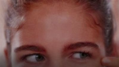أعراض الكوليسترول عند النساء قد تظهر في صورة علامة تستهدف العين… لماذا يجب فحص العين يوميًا؟